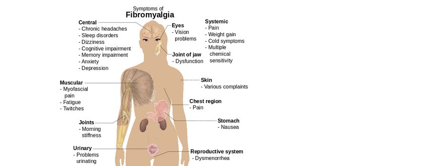 Fibromyalgia Natural Remedies